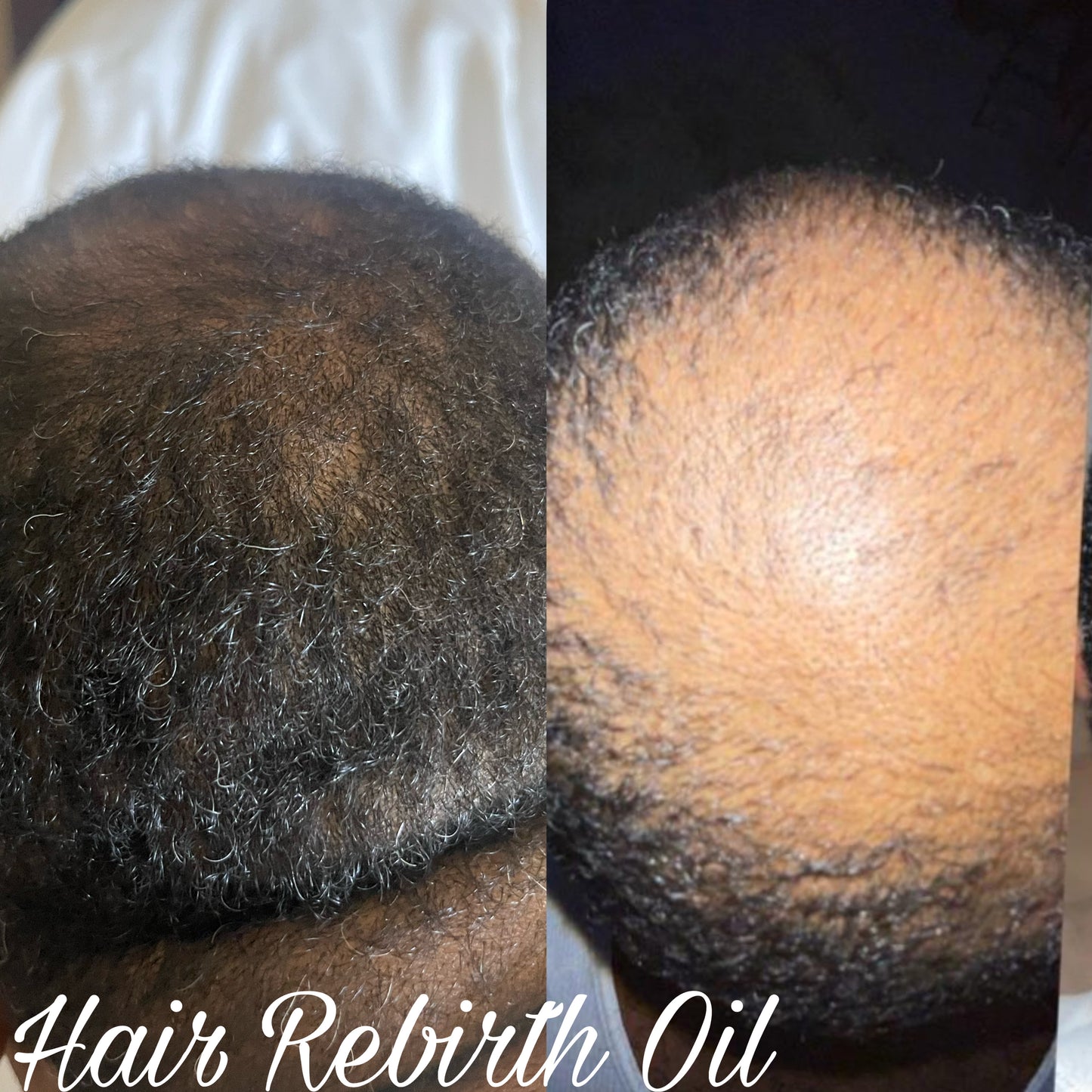 Hair Rebirth Oil